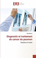 Diagnostic et traitement du cancer du poumon