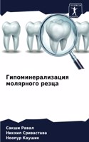 Гипоминерализация молярного резца