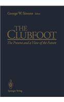 Clubfoot