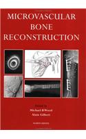 Microvascular Bone Reconstruction