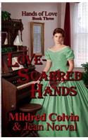Love-Scarred Hands