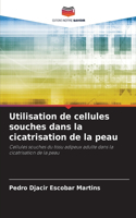 Utilisation de cellules souches dans la cicatrisation de la peau