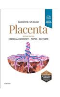 Diagnostic Pathology: Placenta