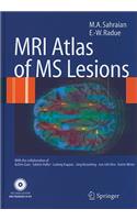 MRI Atlas of MS Lesions