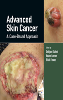 Advanced Skin Cancer