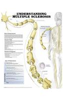 Understanding Multiple Sclerosis Anatomical Chart