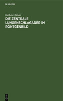 Die Zentrale Lungenschlagader Im Röntgenbild