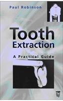 Tooth Extraction
