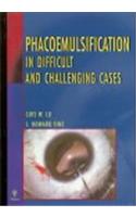 Phacoemulsification in Difficult and Challenging Cases