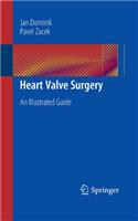 Heart Valve Surgery