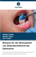 Beweise für die Wirksamkeit von Silberdominfluorid bei Zahnkaries