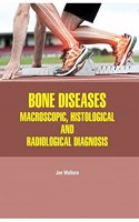 BONE DISEASES: MACROSCOPIC, HISTOLOGICAL AND RADIOLOGICAL DIAGNOSIS(HB)
