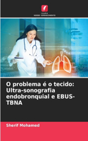 O problema é o tecido