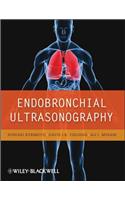 Endobronchial Ultrasonography