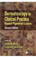 Dermatoscopy in Clinical Practice