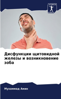 Дисфункции щитовидной железы и возникнов