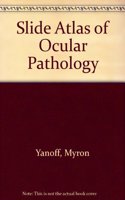 Slide Atlas of Ocular Pathology