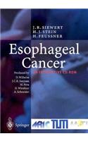 Esophageal Cancer