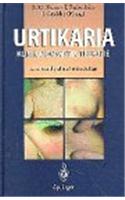 URTIKARIA