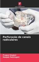 Perfuração de canais radiculares