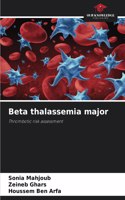 Beta thalassemia major