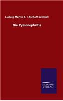 Pyelonephritis