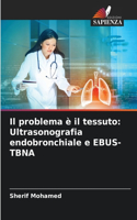 problema è il tessuto