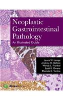 Neoplastic Gastrointestinal Pathology: An Illustrated Guide