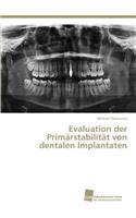 Evaluation der Primärstabilität von dentalen Implantaten