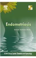 Endometriosis - ECAB