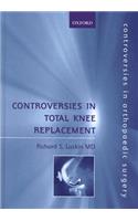 Controversies in Total Knee Replacement