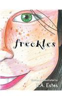 Freckles
