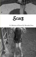 Scars