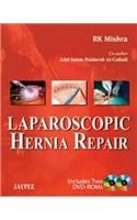 Laparoscopic Hernia Repair