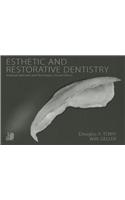 Esthetic and Restorative Dentistry: Material Selection and Technique