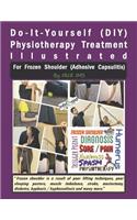 Physiotherapy Treatment Illustrated for Frozen Shoulder (Adhesive Capsulitis)