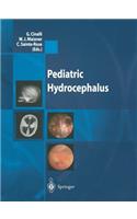 Pediatric Hydrocephalus