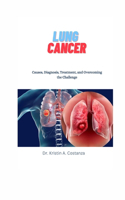 Lung Cancer: Causes, Diagnosis, Treatment, and Overcoming the Challenge