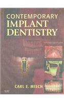 Contemporary Implant Dentistry