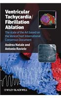 Ventricular Tachycardia / Fibrillation Ablation