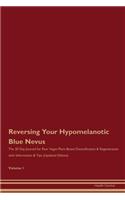 Reversing Your Hypomelanotic Blue Nevus: The 30 Day Journal for Raw Vegan Plant-Based Detoxification & Regeneration with Information & Tips (Updated Edition) Volume 1