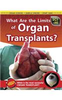 What Are the Limits of Organ Transplants?