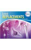 Joint Replacements