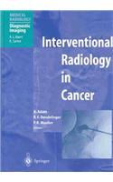 Interventional Radiology in Cancer