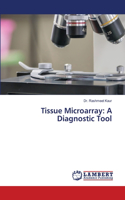 Tissue Microarray: A Diagnostic Tool
