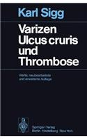 Varizen, Ulcus Cruris Und Thrombose