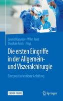 Ersten Eingriffe in Der Allgemein- Und Viszeralchirurgie