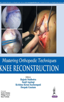 Mastering Orthopedic Techniques: Knee Reconstruction