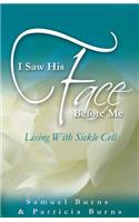 I Saw His Face Before Me - Living with Sickle Cell Anemia