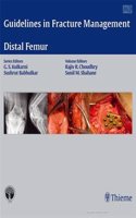 Guidelines in Fracture Management-Distal Femur